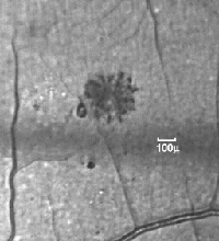 Fragment of the retina image obtained by SFSRI